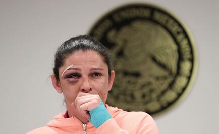 "Es un hecho cobarde", asegura Ana Guevara tras agresión