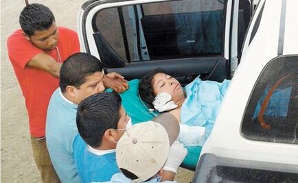 Muere mujer que fue quemada por pastor para "liberarla del demonio"