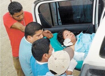 Muere mujer que fue quemada por pastor para "liberarla del demonio"