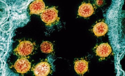 ¿Qué es una cepa de virus?