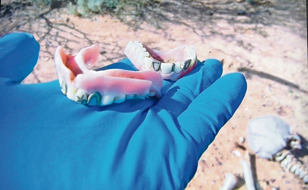Dientes con incrustaciones de plata, al igual que otras señas particulares como alguna placa metálica o deformaciones en el cuerpo, han permitido a familiares identificar a sus seres queridos. Foto: Especial.