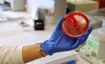 Una visita a los laboratorios que buscan el origen del brote de listeriosis