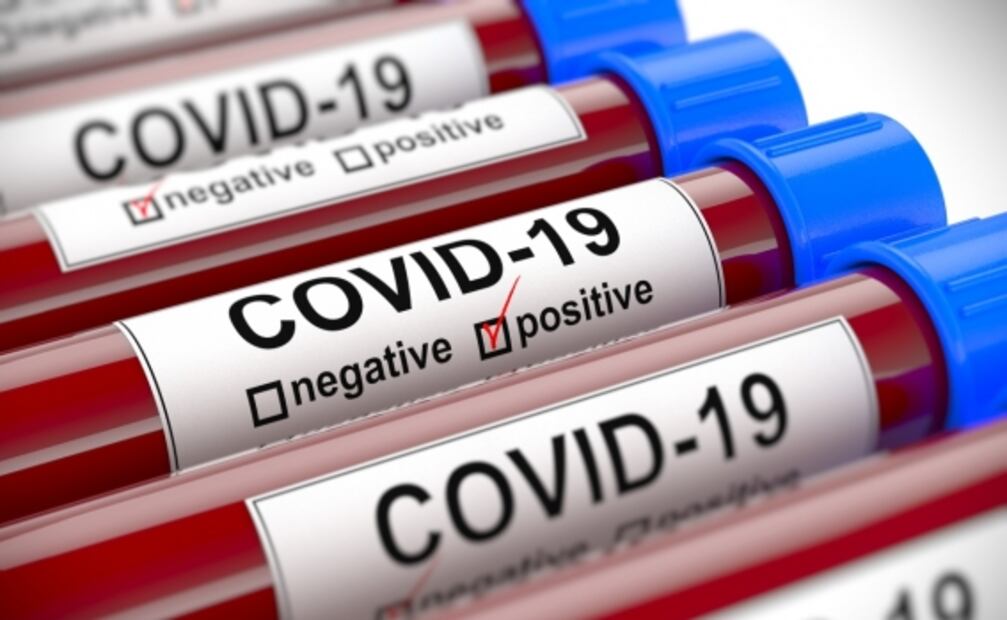 Errores que debes evitar si te haces prueba de Covid para ir a Estados Unidos