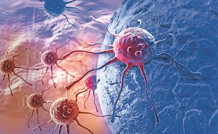 Liver cancer on the rise 