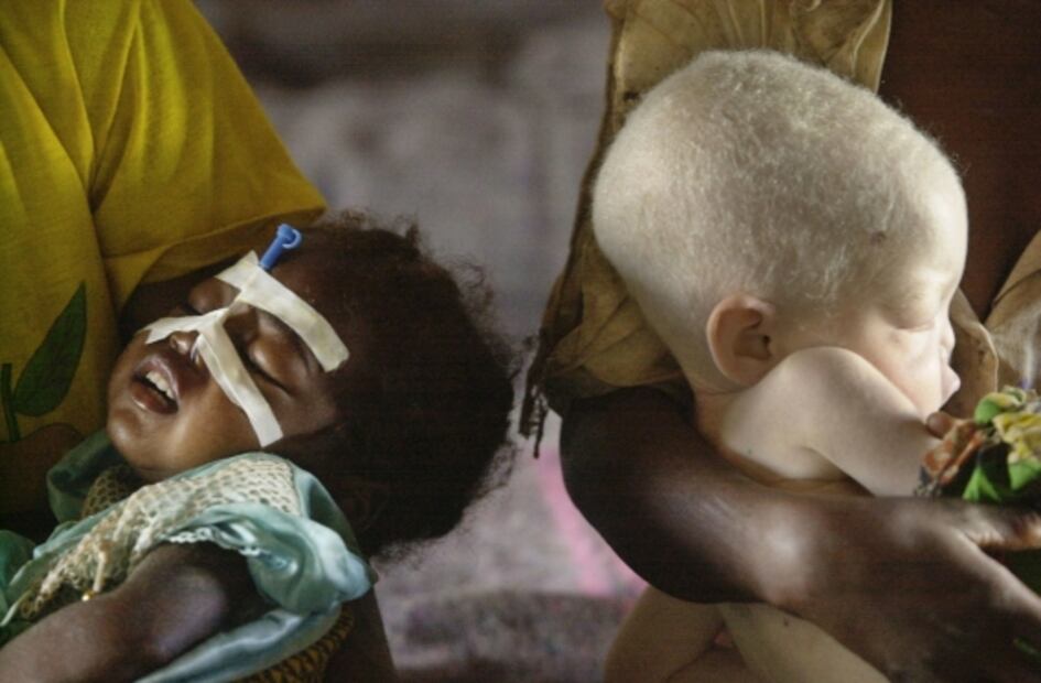 Casos de malaria pueden aumentar debido al cambio climático en África