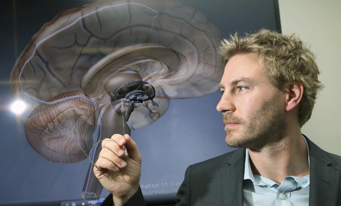 Foto: EFE / David Crosling, archivo