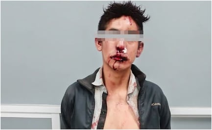 ¡Se busca! Vecinos intentan linchar a sujeto que mató a niña de 2 años; policías lo trasladan al hospital y escapa