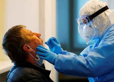 Laboratorios estiman que hasta 20% de las pruebas Covid-19 son falsas