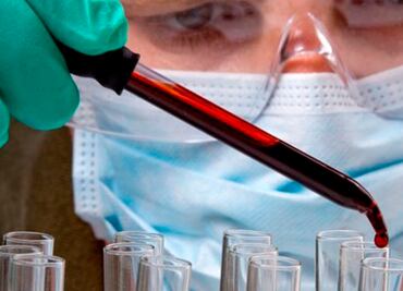 Contra el VIH solo funcionan los antirretrovirales, alertan los científicos