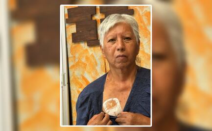 Presa Endhó, Caldo de cultivo para el Cáncer