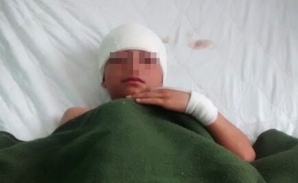 Explota cohete a menor en Nezahualcóyotl 