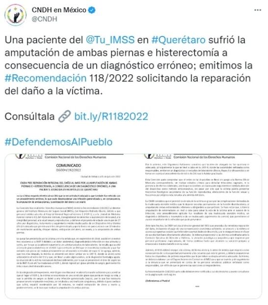 Amputan piernas y extirpan útero y ovario a mujer por mala atención médica; CNDH emite recomendación al IMSS