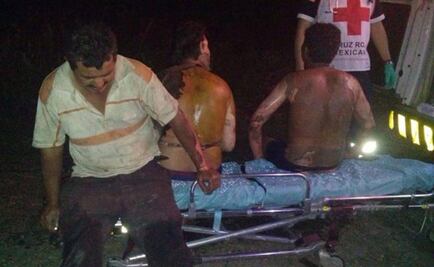 Explosion leaves 30 injured in Tabasco