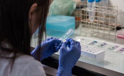 Más de mil muertes anuales asociadas al mieloma múltiple en México; el diagnóstico oportuno podría cambiar las cifras, dice experto