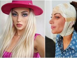 ¿Quién era Bárbara Jankavski, la Influencer que murió tras someterse a 27 cirugías estéticas?