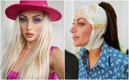 ¿Quién era Bárbara Jankavski, la Influencer que murió tras someterse a 27 cirugías estéticas?