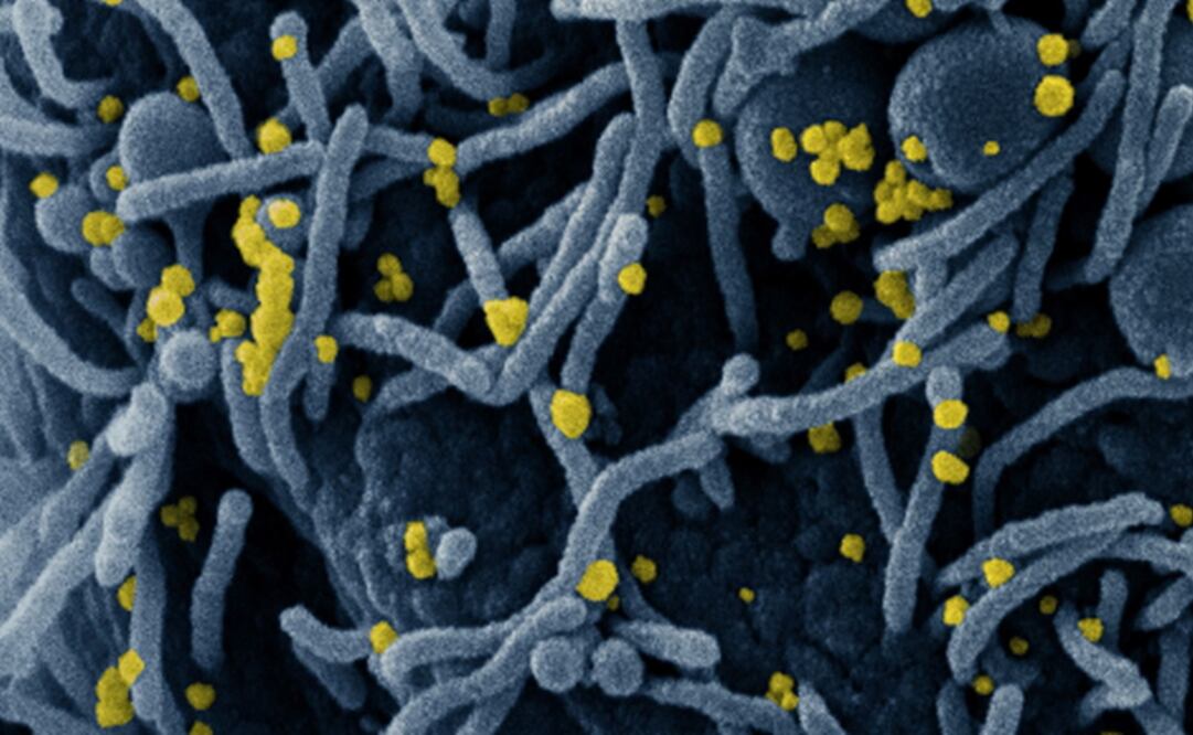 Foto: EFE/EPA/NIAID/NATIONAL INSTITUTES OF HEALTH HANDOUT 