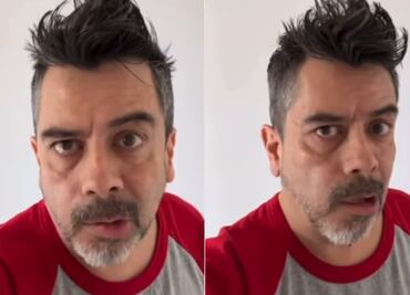 Carlos Espejel reaparece con parálisis facial; atribuye su condición al estrés