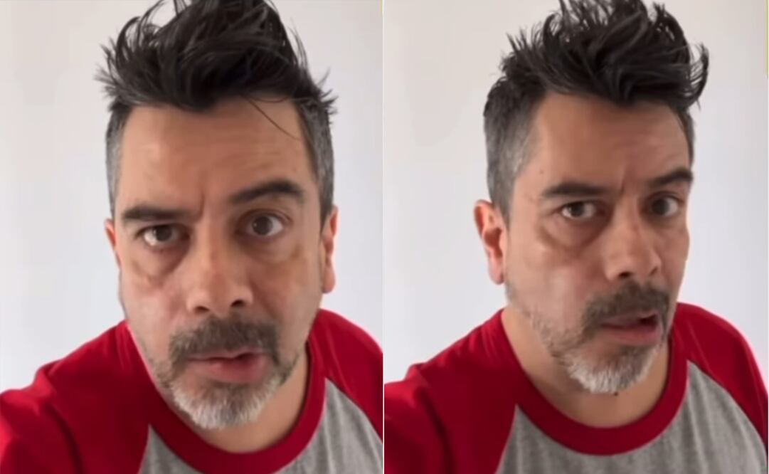 El actor causó preocupación entre sus seguidores. Foto: Captura de pantalla.