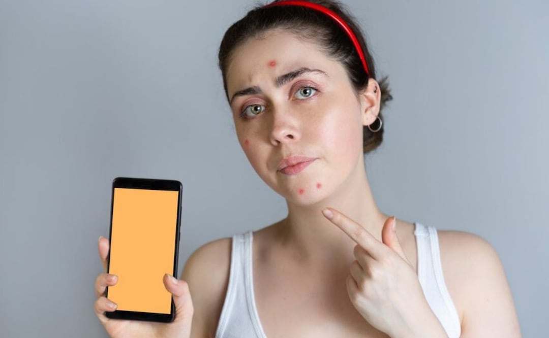 Cómo evitar que el uso del móvil provoque acné o empeore. Fuente: Freepik.
