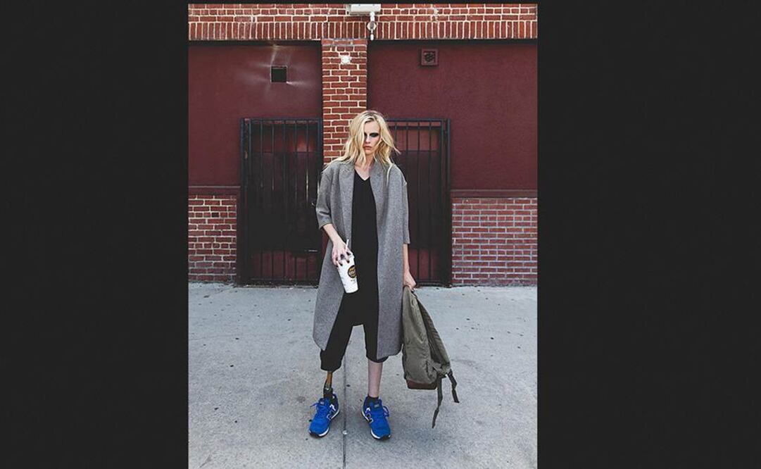 Debido a una gangrena tuvieron que amputarle la pierna  Foto: Tomada de people.com