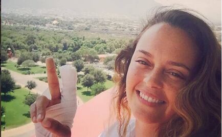 Tras perder parte de su dedo, Shaila Dúrcal muestra su recuperación 