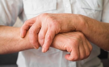 Las 5 condiciones que aumentan el riesgo de que sufras artritis