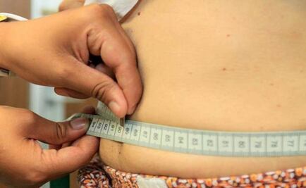 Many obese young adults unaware of kidney disease risk