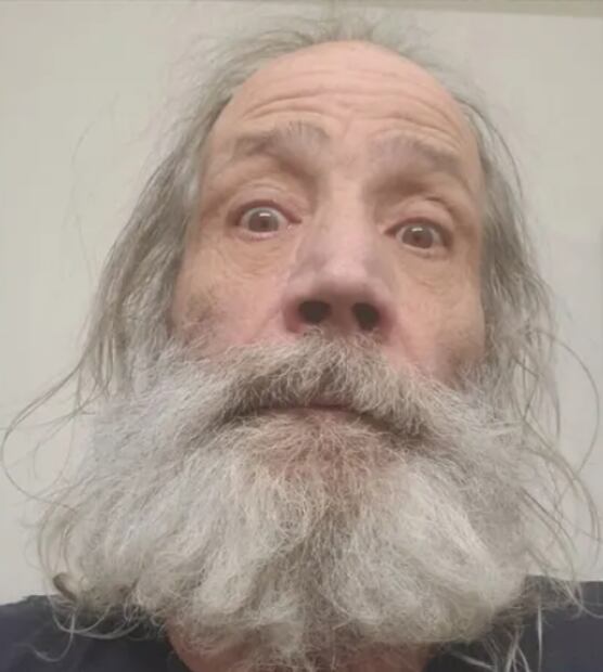 En sus últimos años, Kevin DiCicco enfrentó dificultades personales significativas, incluyendo problemas de salud crónicos (EPOC y depresión) y periodos de falta de vivienda, lo que llevó a sus seguidores a organizar campañas de apoyo para su cuidado médico.
Así lucía en 2024.