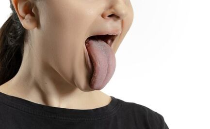 Esto quiere decir el color de tu lengua sobre tu estado de salud
