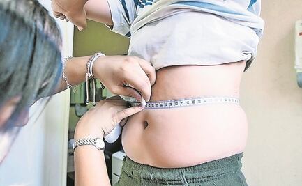 Padecen obesidad 4 de cada 10 derechohabientes: IMSS