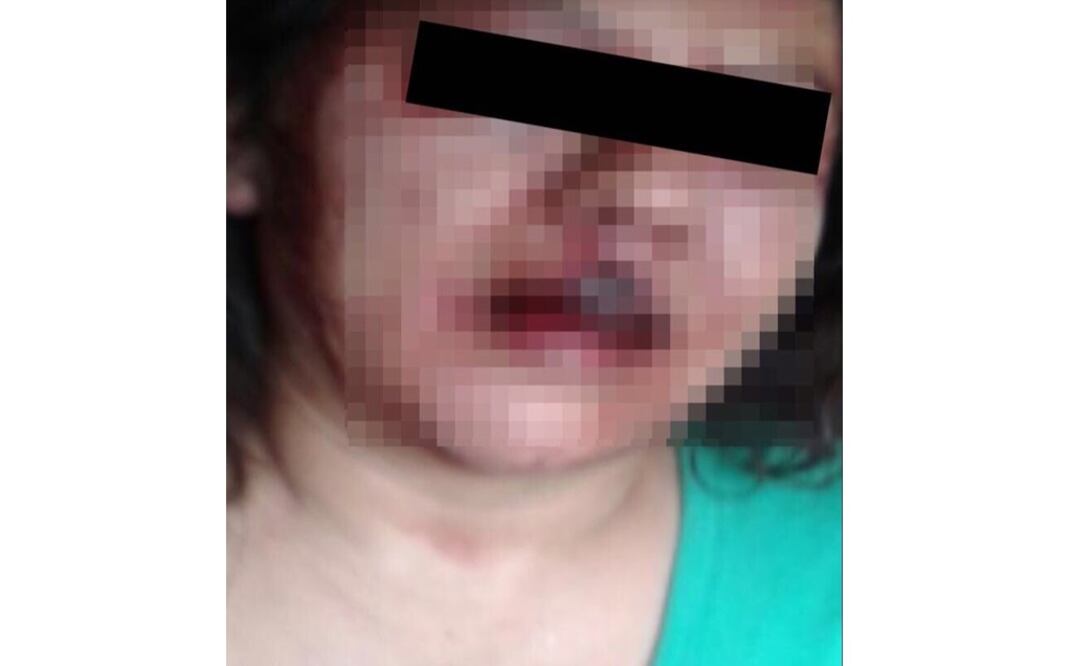 (Foto: SSP de la CDMX)