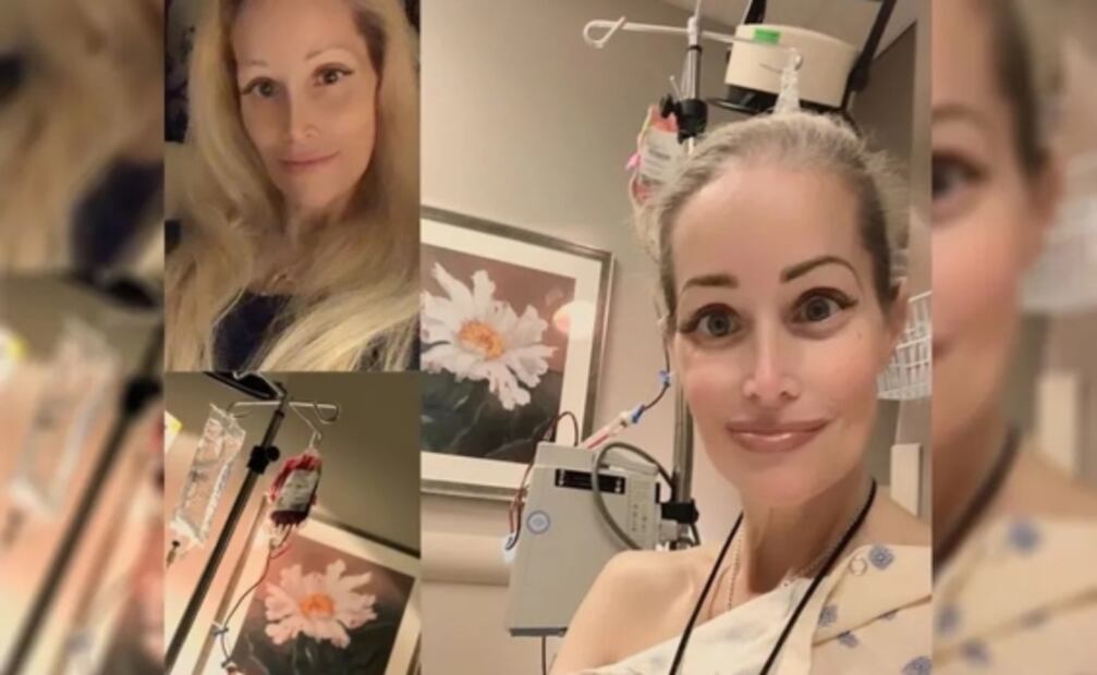 Se aplica 30 inyecciones en los labios, quiere ser una Barbie