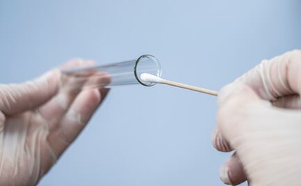 ¿Qué es la autotoma de muestra para detectar Covid-19?