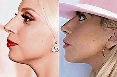 Acusan a Gaga de traicionar ideales con su cirugía estética