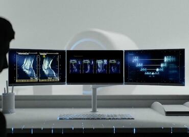 Con inteligencia artificial transformarán las resonancias magnéticas