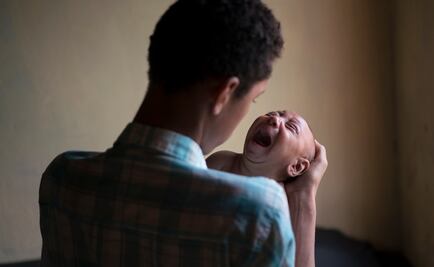 Entérate. ¿Qué es y qué causa la microcefalia?