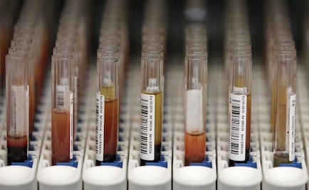 UNAM scientists participate in global proteome research