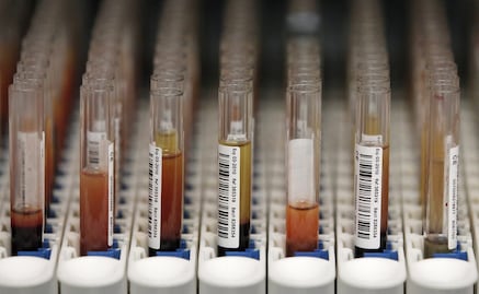 UNAM scientists participate in global proteome research