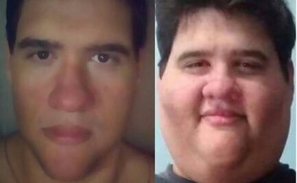 Muere Gabriel Freitas, influencer que pesaba más de 300 kilos tras un fallo cardiorrespiratorio; ¿quién era?