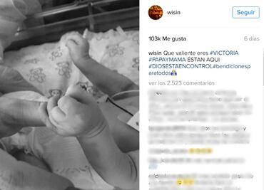 Trisomia 13, trastorno genético del que murió la hija de Wisin