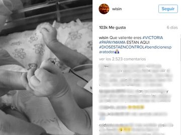 Trisomia 13, trastorno genético del que murió la hija de Wisin