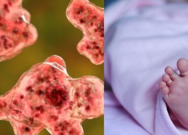 Bebé de dos años fallece en Nevada a causa de una rara ameba "come" cerebros