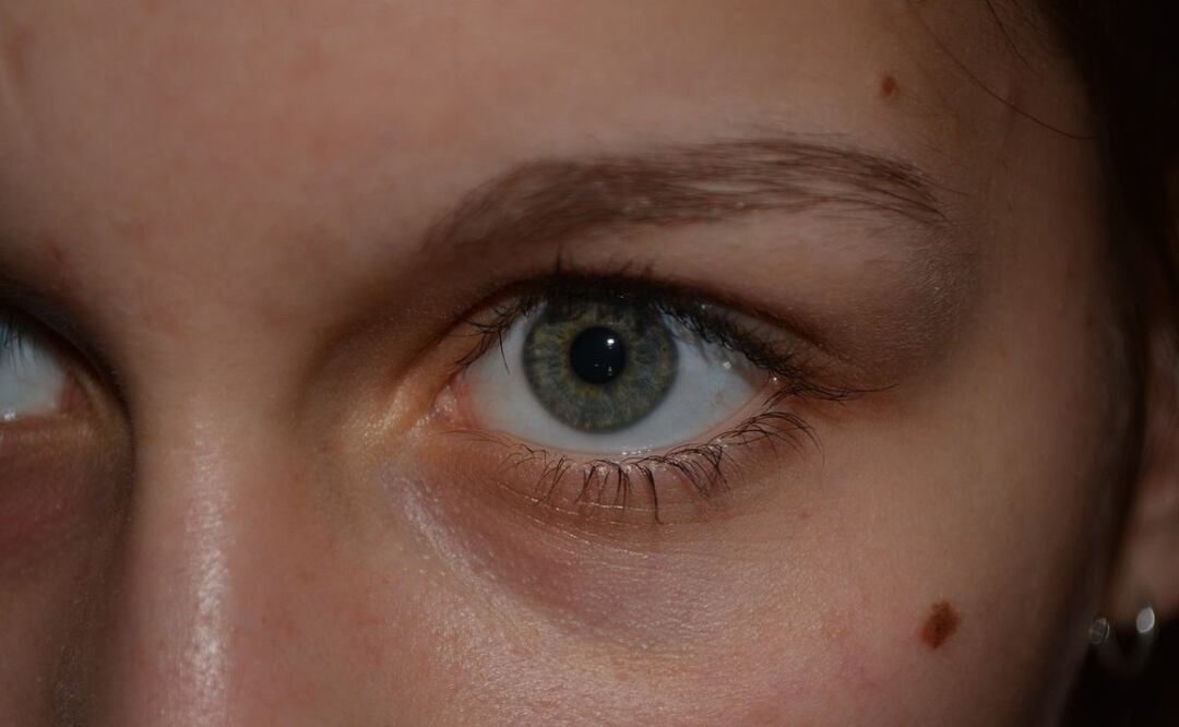 Lunares. Fuente: Pixabay