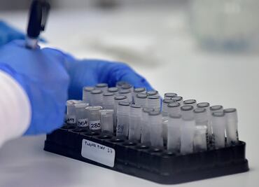 Desarrollan medicamento con plasma de pacientes recuperados de Covid-19