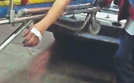 Tras discusión, hombre le dispara a su novia con escopeta en Cuajimalpa