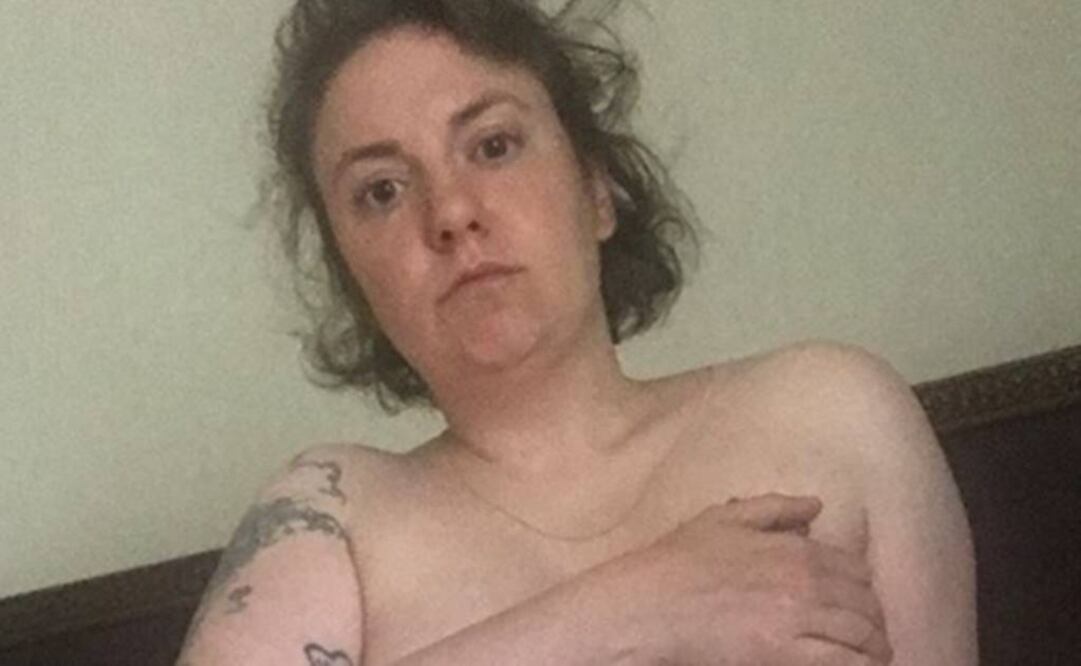 Lena Dunham padeció durante más de una década de endometriosis FOTO: INSTAGRAM