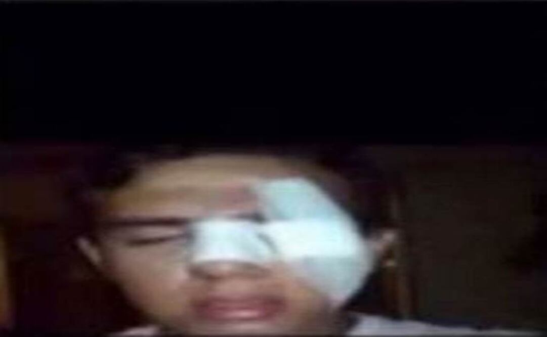 One of those involved was beaten by people who had already seen the videos. (Photo: Special )