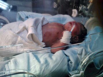 Parto 'post mortem' salva vida a bebé