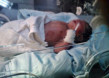 Parto 'post mortem' salva vida a bebé